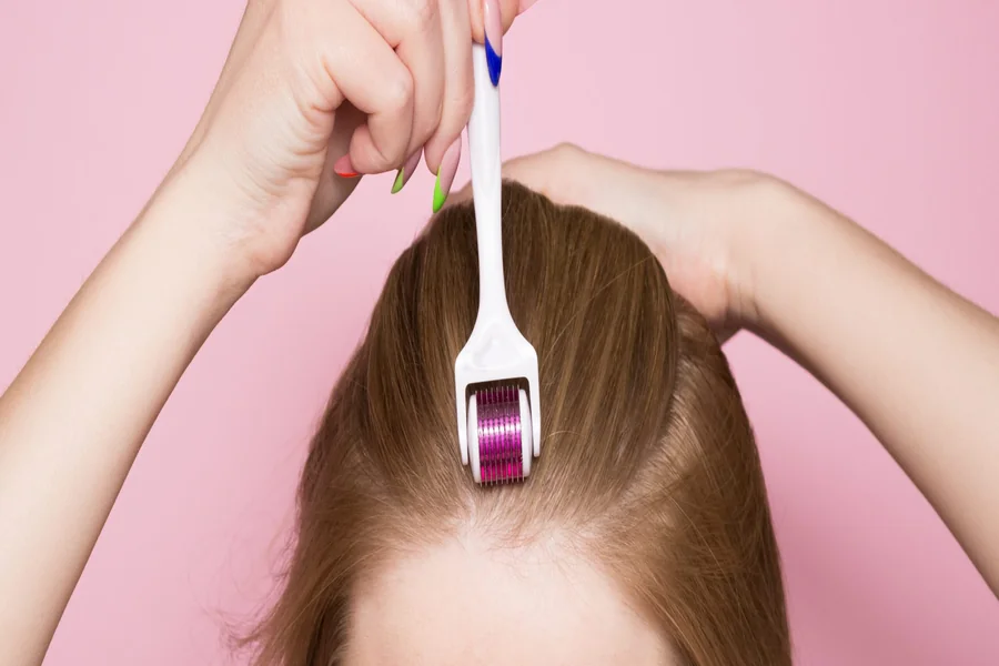 Advanced Scalp Therapy: The Science and Efficacy of Hair Microneedling Hair Microneedling